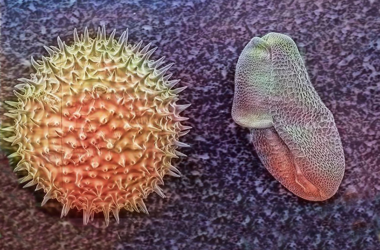 Микрофото - шарики-пыльца мальвы, сплющенная - пыльца лилии